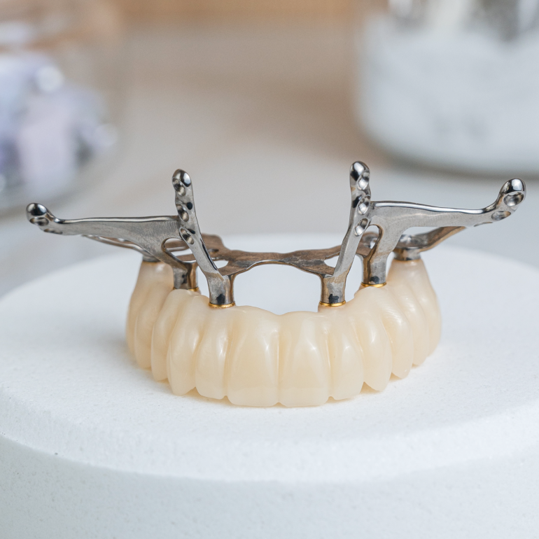 carga-inmediata-aragoneses