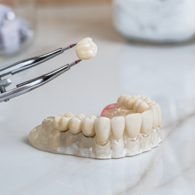 protesis_fija_sin_metal-aragoneses